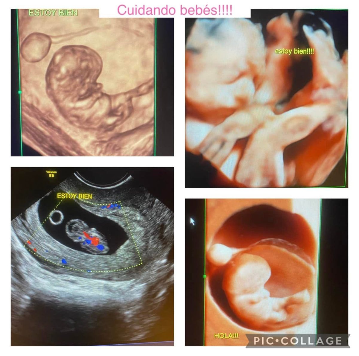 Ultrasonidos de control prenatal